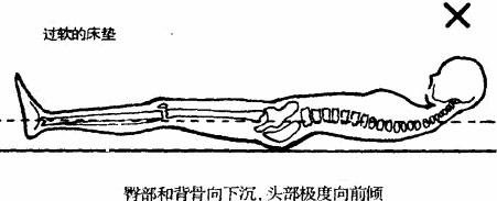 程序员、白领如何保护自己的颈椎 程序员、白领如何保护自己的颈椎