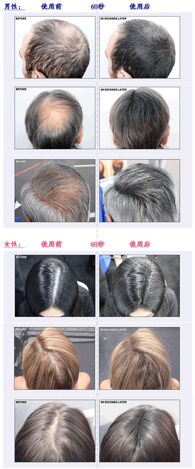 剪了短发不好看,<em>怎么让头发长快点</em>,渡过这段时