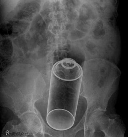 如何看待电视剧里《一起打鬼子》<em>银妹</em>的戏?