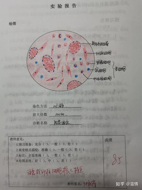 病理学组织切片红蓝铅手绘图