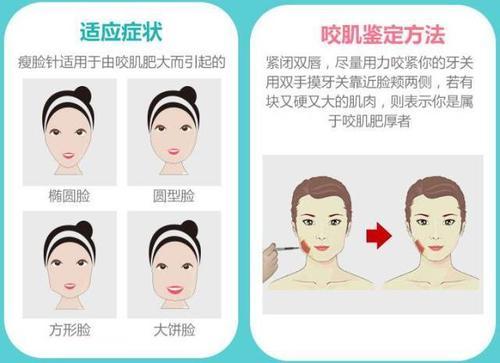 打瘦脸针的肉毒素进价多少一只