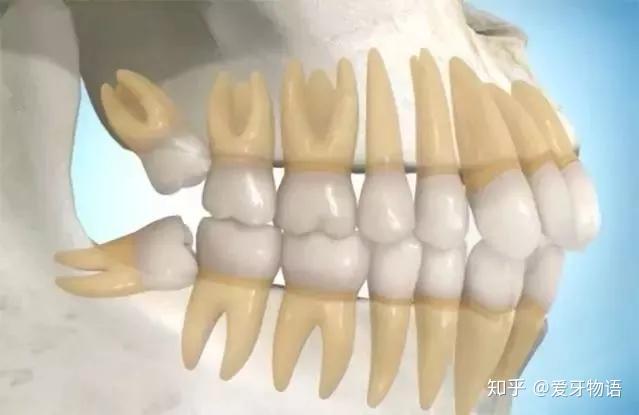 牙疼的部位集中在两侧的后槽牙位置,牙龈红肿或发白,有时可以看到还未