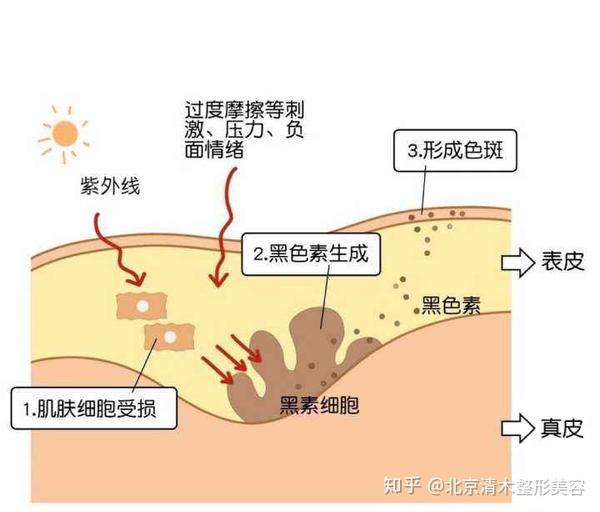 黑色素是如何产生的有什么作用