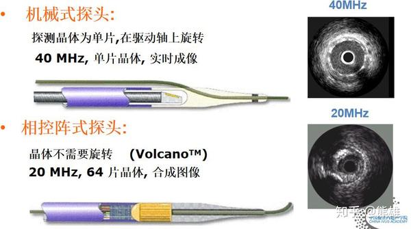 ivus两种不同的超声探头