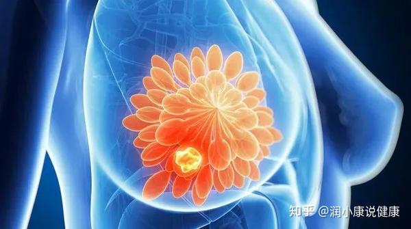 润康:乳腺增生=乳腺癌?关于它的真相都在这里!
