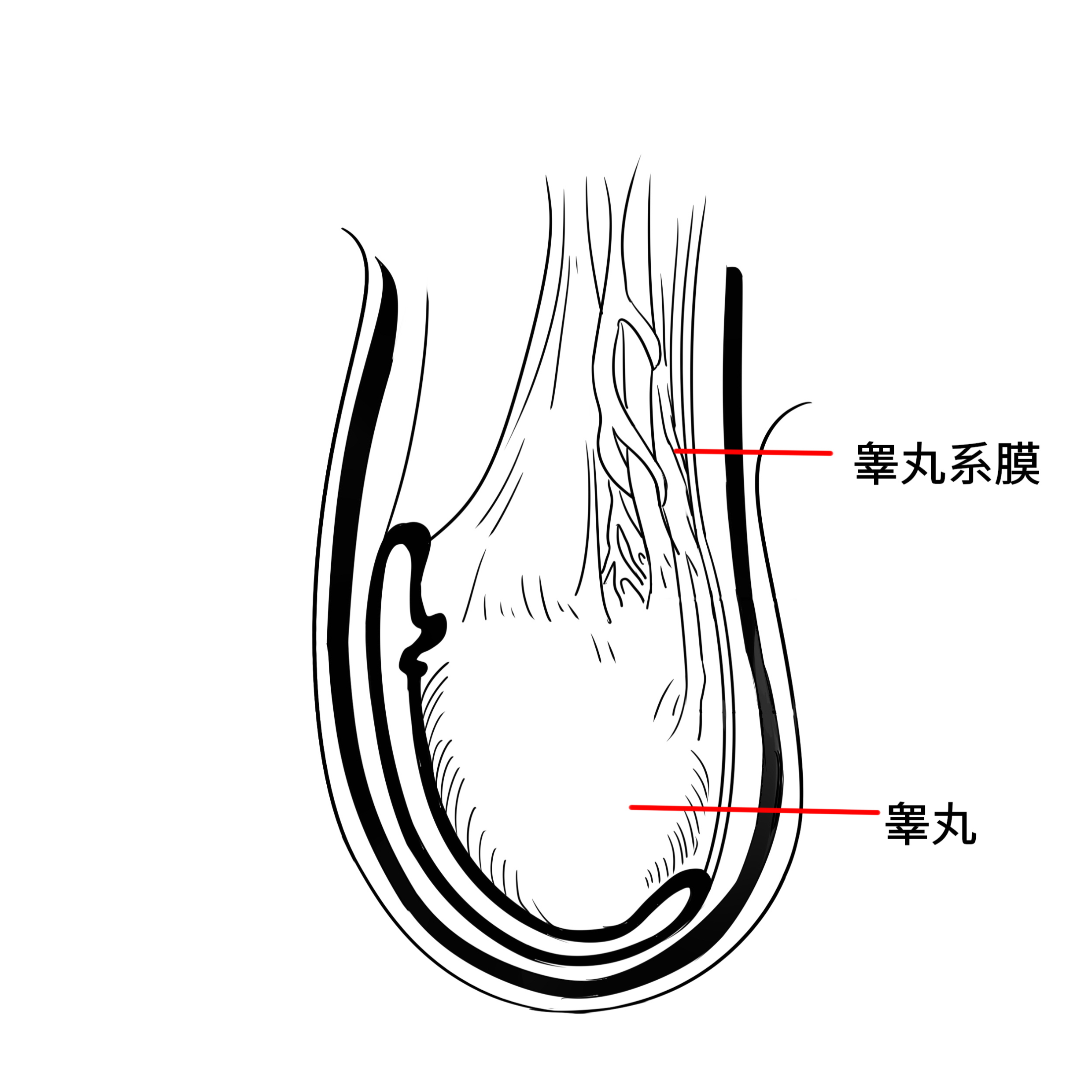 普通人到底要不要担心睾丸扭转