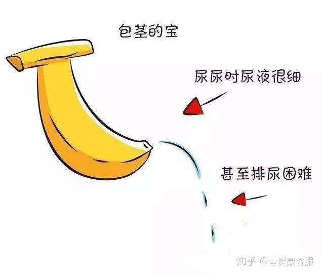 05小儿包茎,包皮过长的危害有哪些?