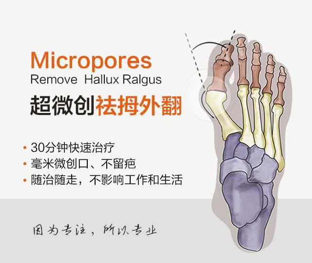 跖痛症脚掌疼前足痛脚掌老茧脚垫病因及治疗