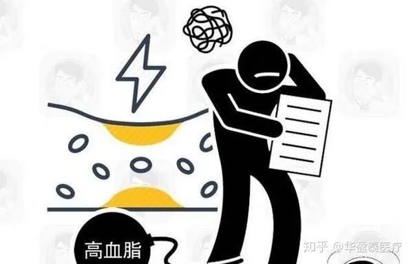 高血脂来得悄无声息这5个症状是在警示你高血脂要来了
