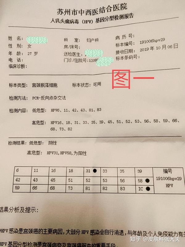 苏州市曹女士hpv31,hpv58型高危转阴病例分享