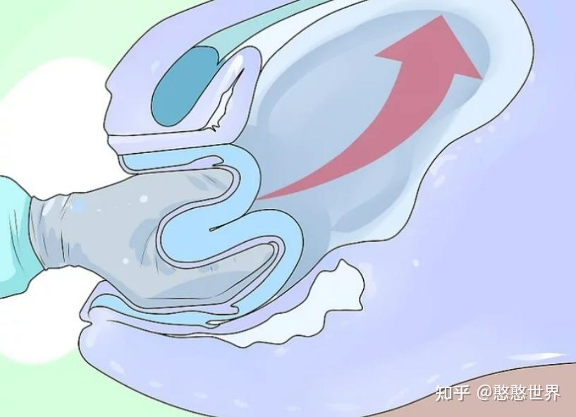 影响子宫的问题有子宫收缩乏力,子宫内翻和子宫破裂.