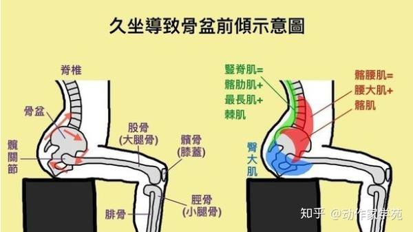 不明原因腰痛,可能是骶髂关节失能
