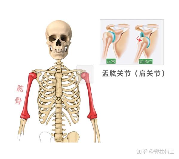 肱骨前移虽然很像圆肩,但根本不是一回事!