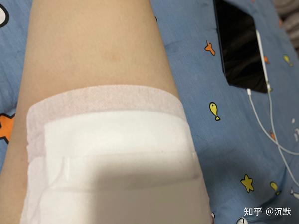 火疖子疥肿痈引流术