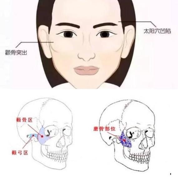 答应你们的下颌角颧骨攻略来咯