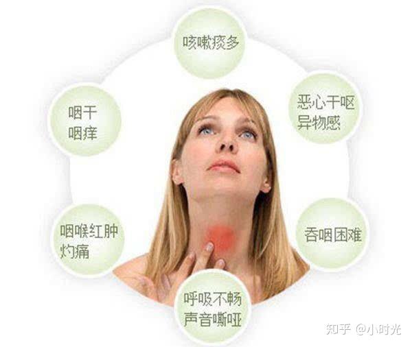 慢性咽炎咳嗽 zhuanlan.zhihu.com