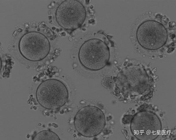 一般情况下,取卵时取出的卵泡液交给胚胎专家在显微镜下观察卵子