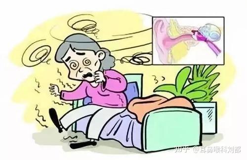 耳石症如何复位?