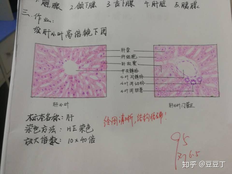 高倍镜下肝小叶和门管区红蓝铅笔手绘图