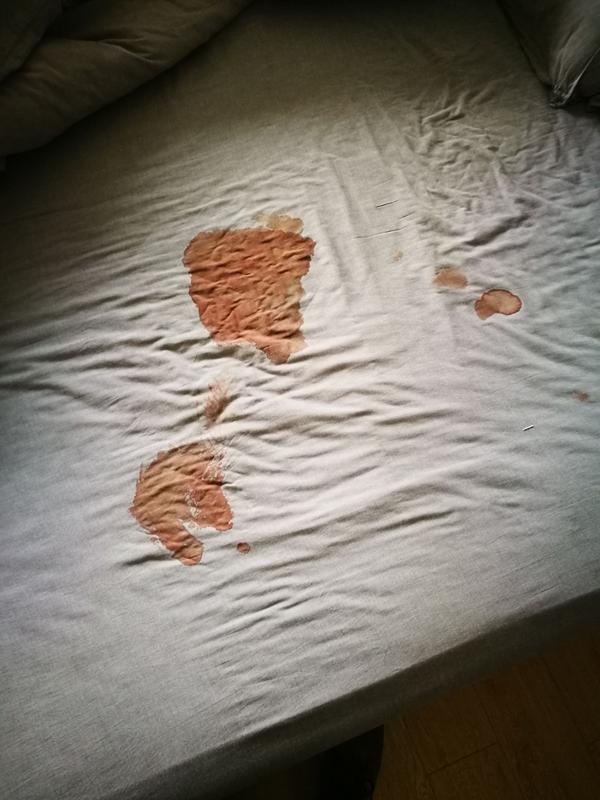 如何洗掉床单上的血迹?