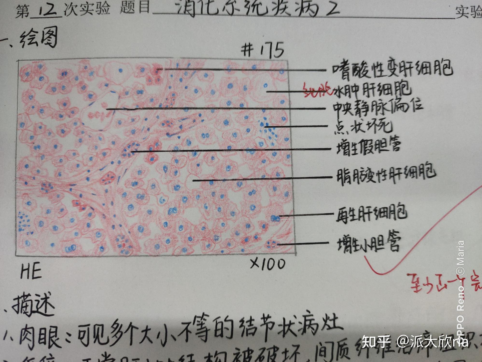 病理学实验报告红蓝铅笔手绘图有老师批改