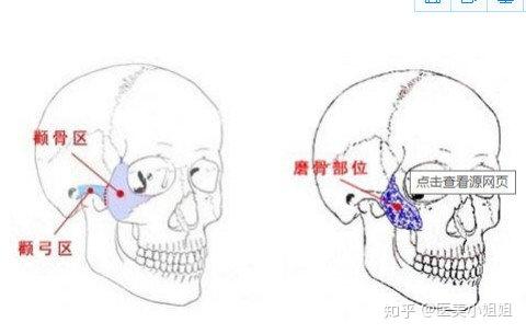 三术式中有很多宝宝想知道,颧骨颧弓手术后,是否会出现下垂的问题?