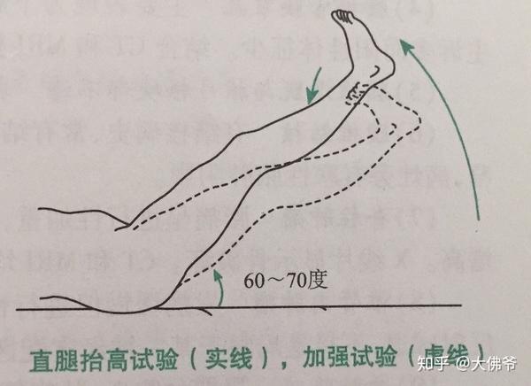 直腿抬高试验及加强试验