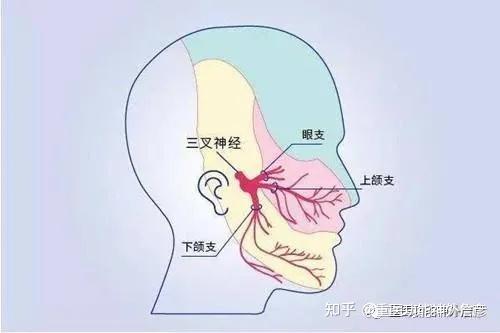 侧脸疼痛也许"坏"不在牙,詹医生带你了解三叉神经痛