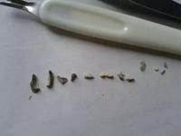 别以为年轻,牙齿就不会掉!遇上"牙周炎"再坚硬的牙都难保 知乎