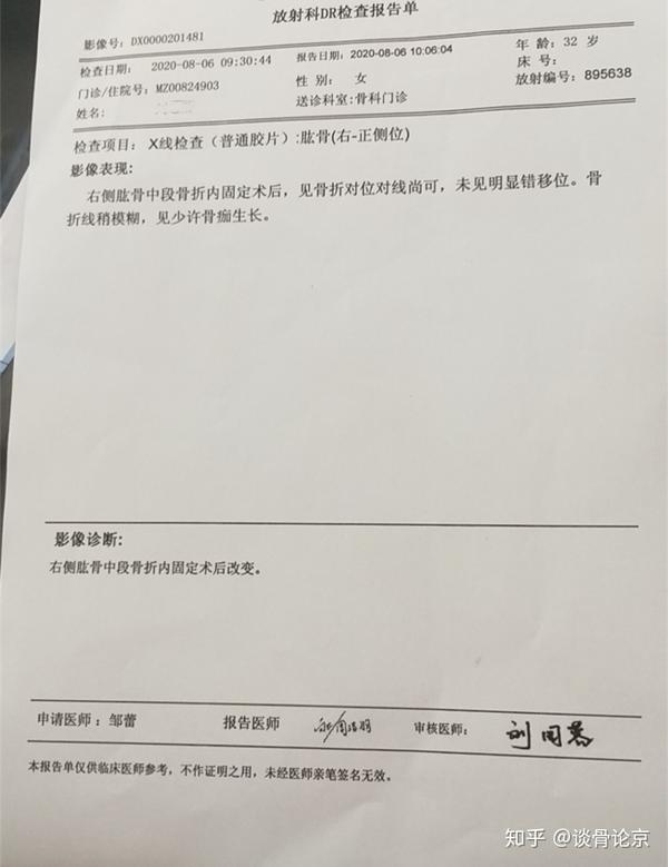 肱骨骨折5个月未愈合患者28天治疗效果骨折延迟愈合治疗案例
