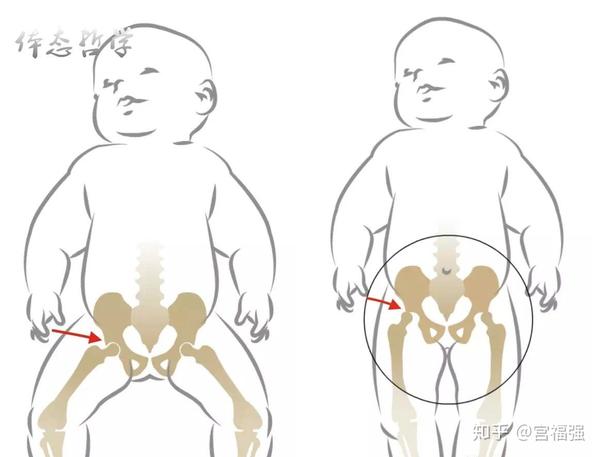 关于宝宝腿型,这些问题你应该知道