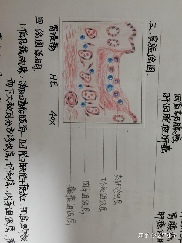 大二临床病理学红蓝铅笔图