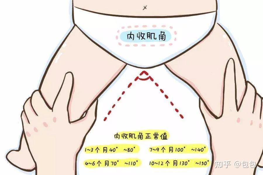 宝宝肌张力高怎么办?不忽视,不焦虑,正确认识肌张力