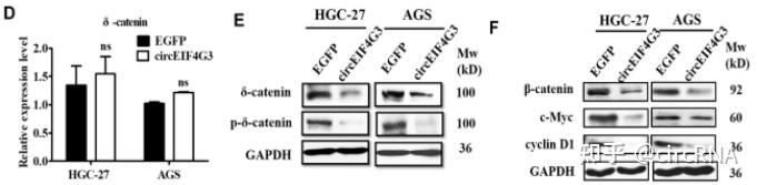 Mol Cancer 许文荣团队联合发现circEIF4G3在胃癌细胞中发挥肿瘤抑制作用 知乎