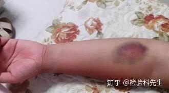 我们该怎么避免?