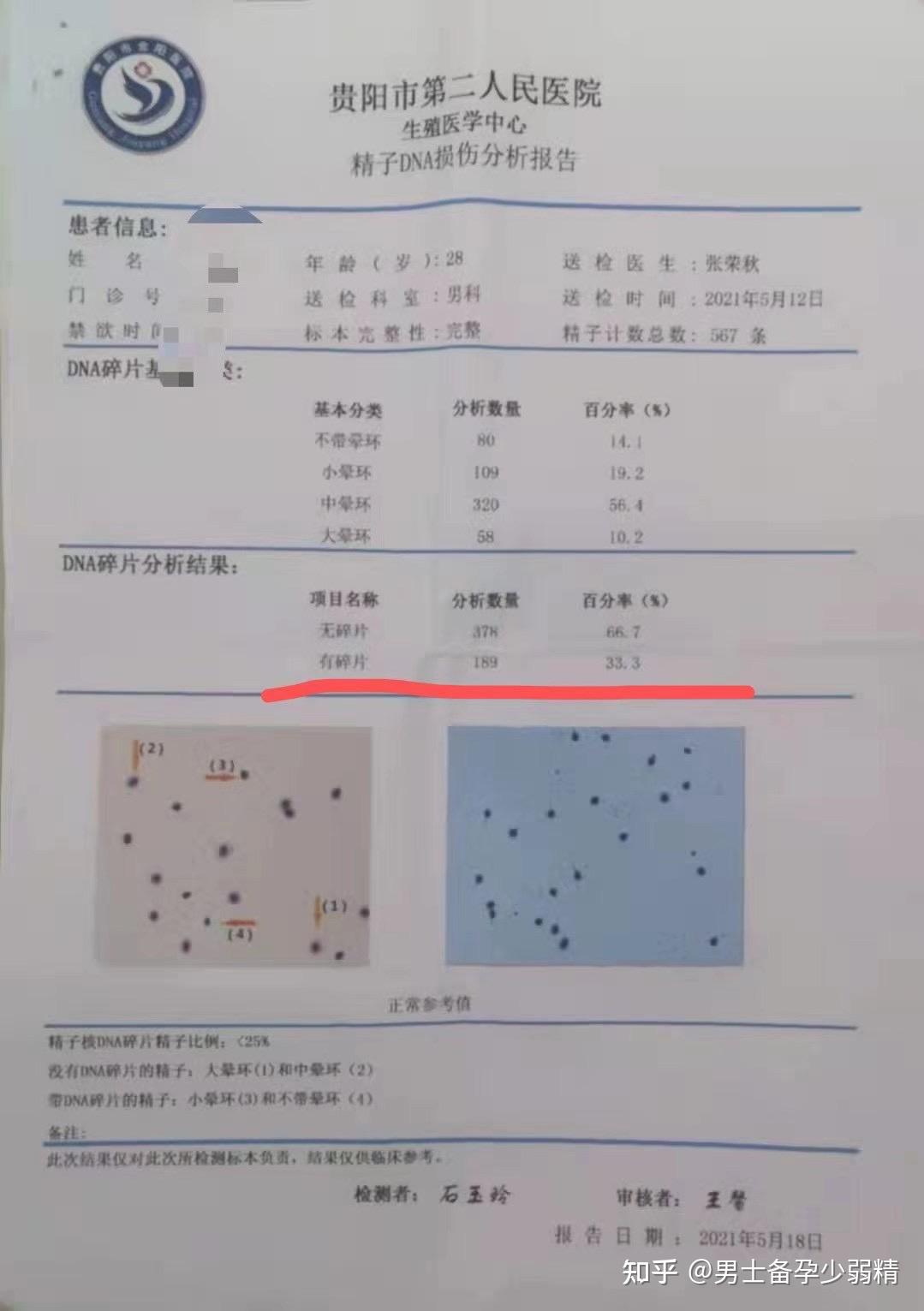 请问男生精子dna碎片化率高该如何治疗呢