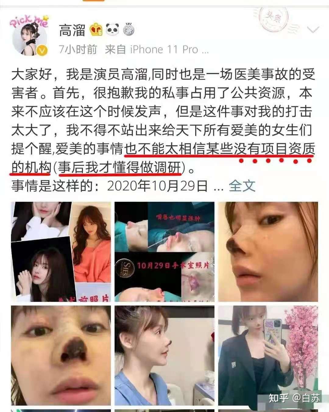 网红小冉吸脂感染去世医院存在术中操作不当等过错将承担什么责任后续