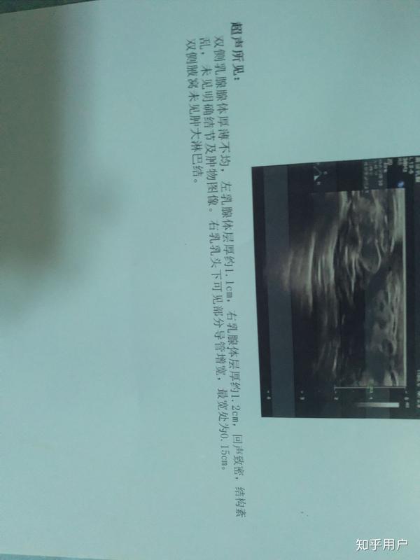 请求治疗肉芽肿性乳腺炎的方法,中医也好,西医也好,给