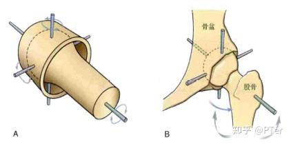 关节进一步分类,包括平面关节,铰链关节,车轴关节,椭圆关节,鞍状关节