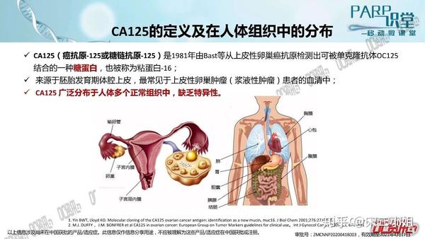 ca125在卵巢癌中的重要意义来自潘凌亚教授的分享