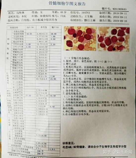 庆阳歌手演员高海燕确诊急性髓系白血病