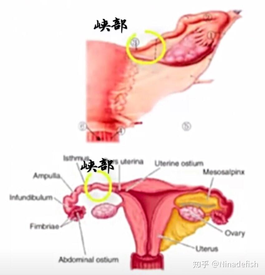 输卵管峡部(结扎的部位)