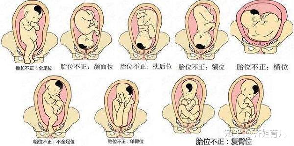 胎位也是判断顺产与否的一个重要指标.