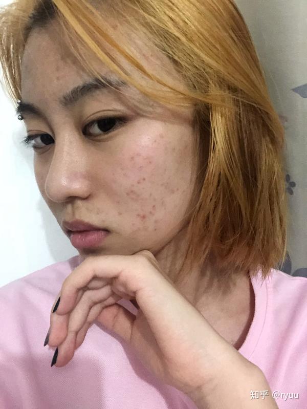 五官好看,皮肤差是什么体验?