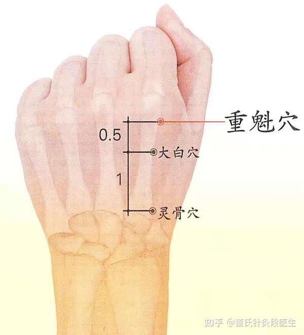 今天给大家分享的是董氏针灸灵骨大白