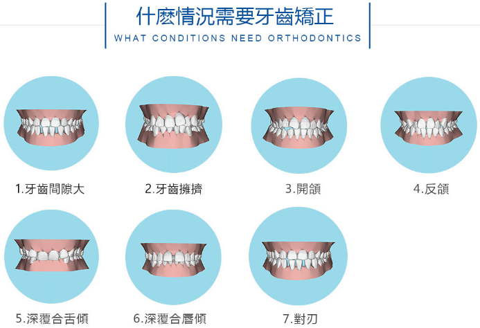 什么牙齿情况需要做矫正?