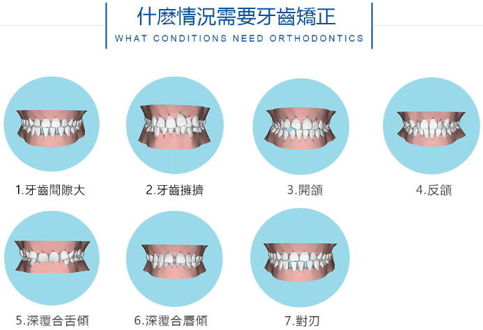 拥挤牙齿的龋病及牙周病发生率均较正常排列牙齿高.