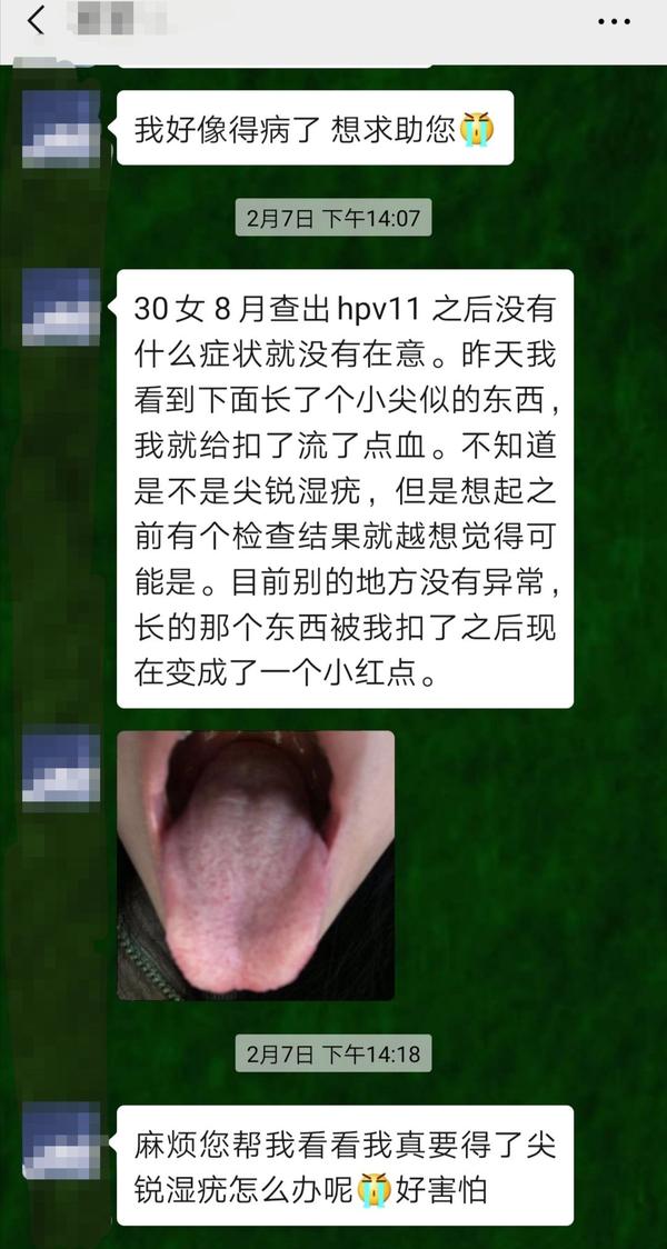 哈哈,艾灸把尖锐湿疣调理得差不多了,就删微信了?