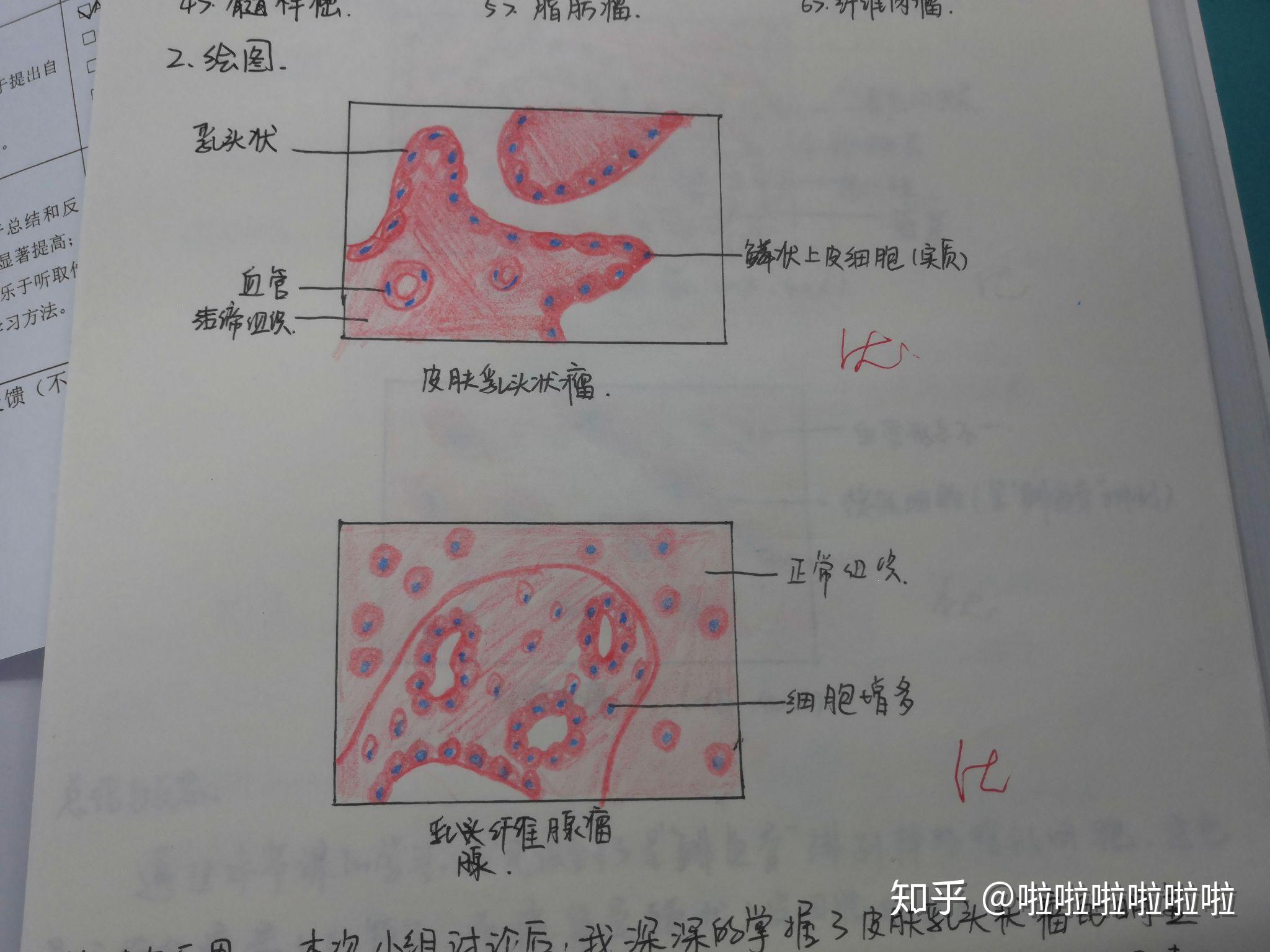 病理学切片红蓝铅笔画