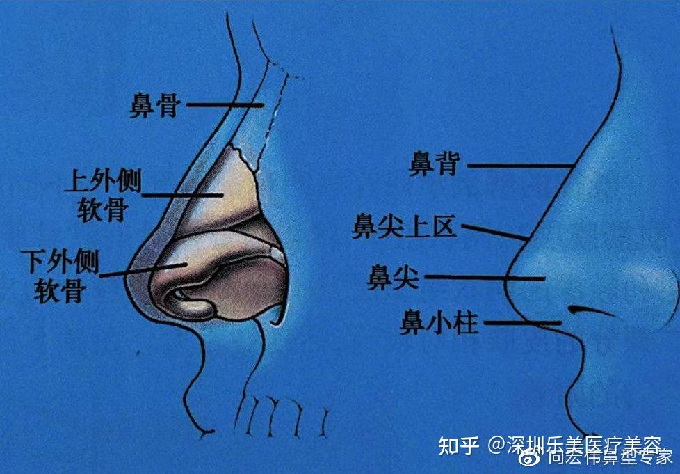 鼻畸形解剖形态1)术前明确解剖目的鼻子,像其他所有的突出结构一样